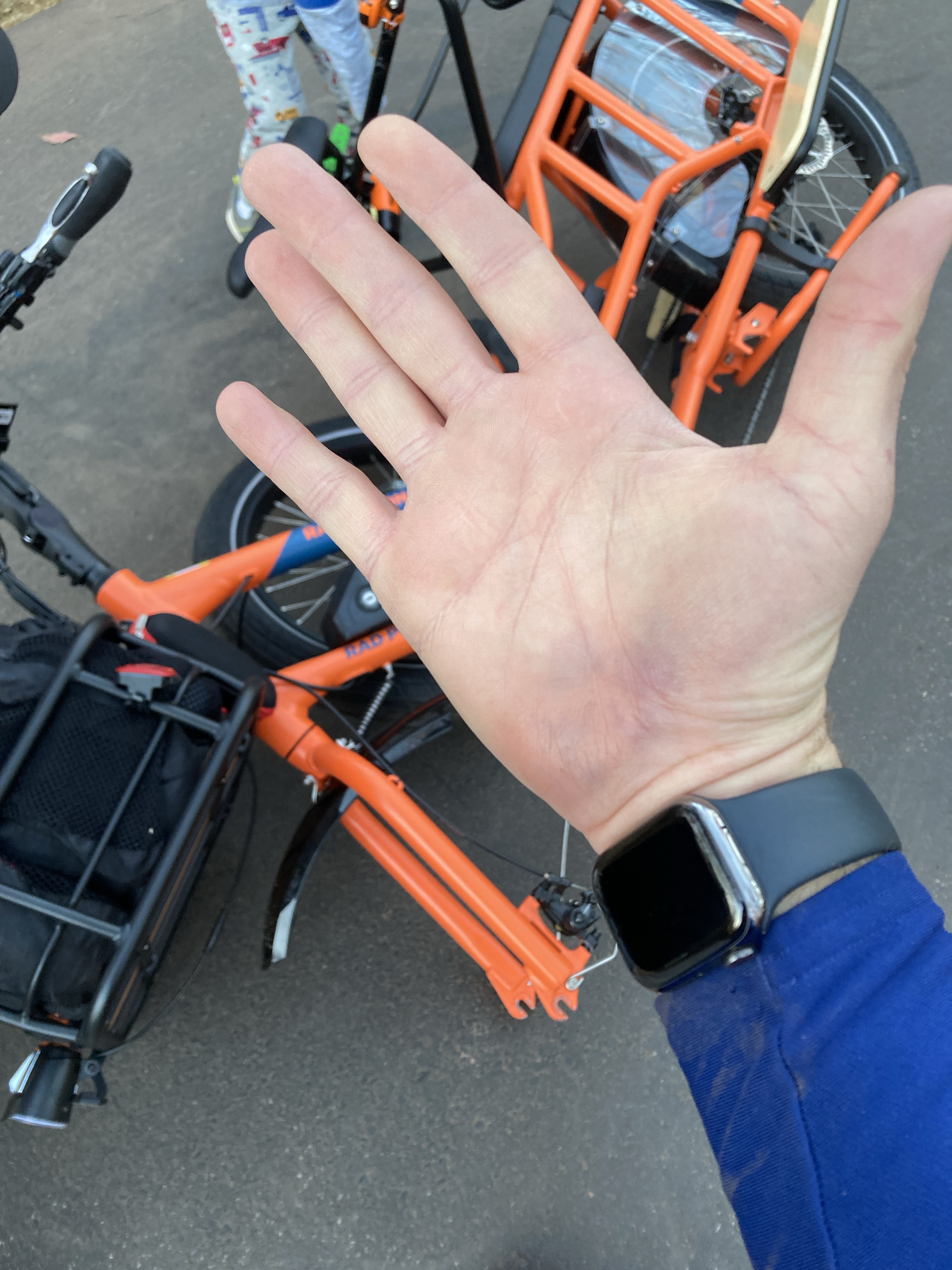 My Hand